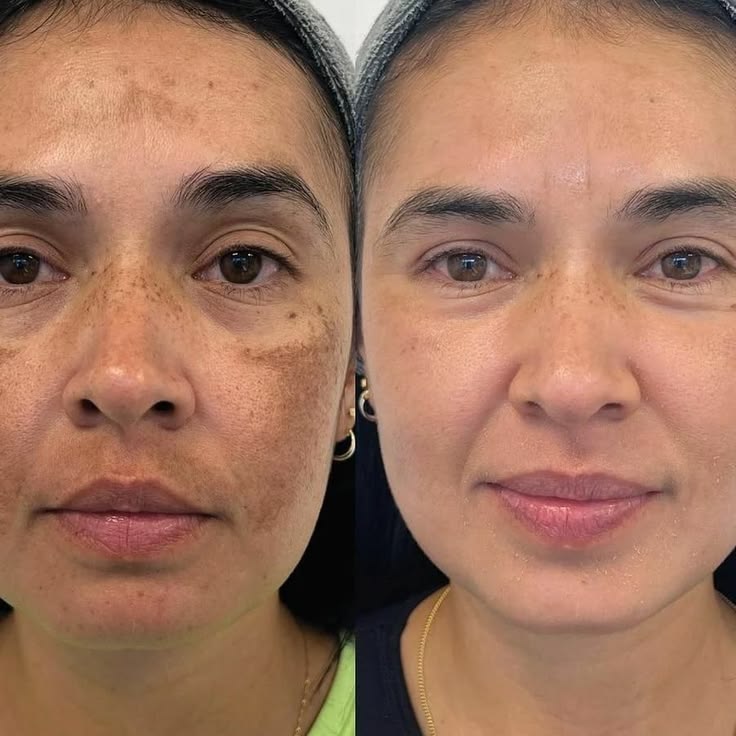 Skin Brightening Night Cream